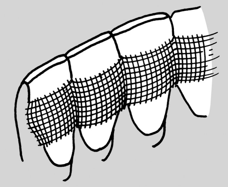 Perfect SplintSystem Hager & Werken